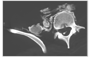 Imagen del estudio de M4 PELVIS Y EXTREMIDADES INFERIORES reproducida en la página 51 del informe original