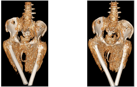 Imagen del estudio de M4 PELVIS Y EXTREMIDADES INFERIORES reproducida en la página 52 del informe original